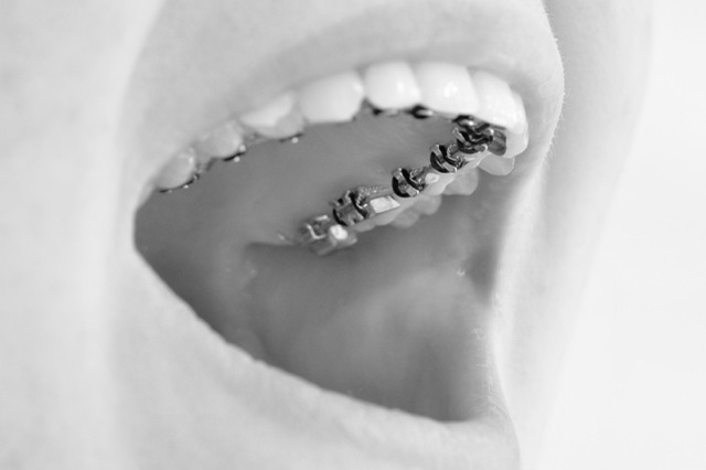 O Keeffe Orthodontics