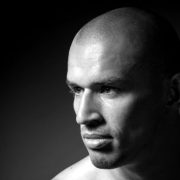 Scalp Pigmentation Ireland